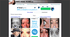 Desktop Screenshot of gravesdiseasepictures.com