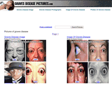 Tablet Screenshot of gravesdiseasepictures.com